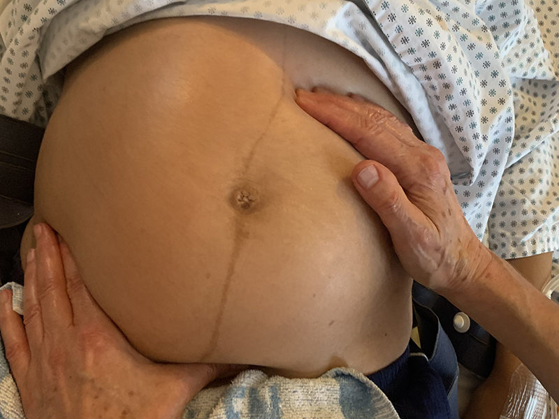 Babybauch 